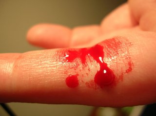 blood spill kits aftermath finger cut injury